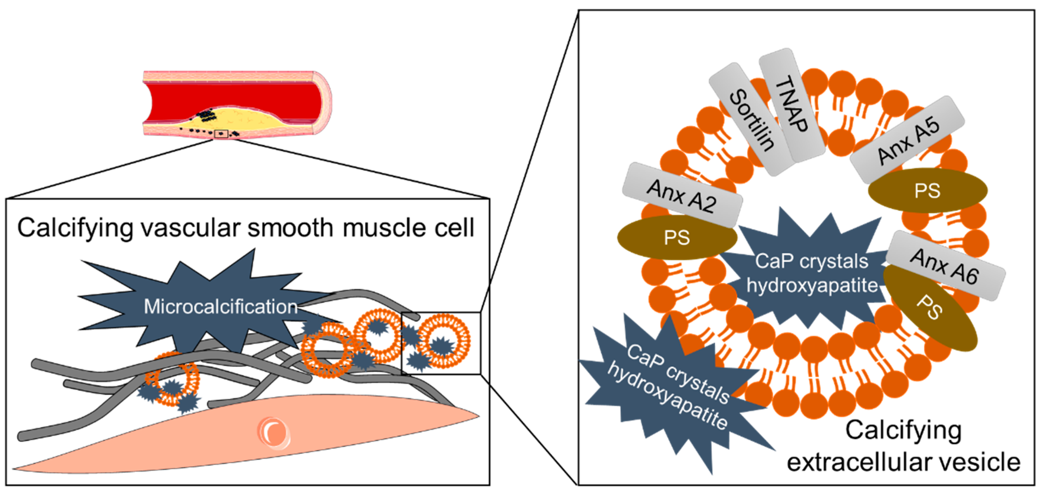 Ectopic ATP synthase stimulates the secretion of extracellular vesicles in  cancer cells