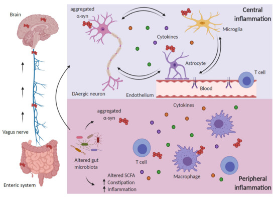 Inflammation in Parkinson’s Disease: Mechanisms and Therapeutic ...