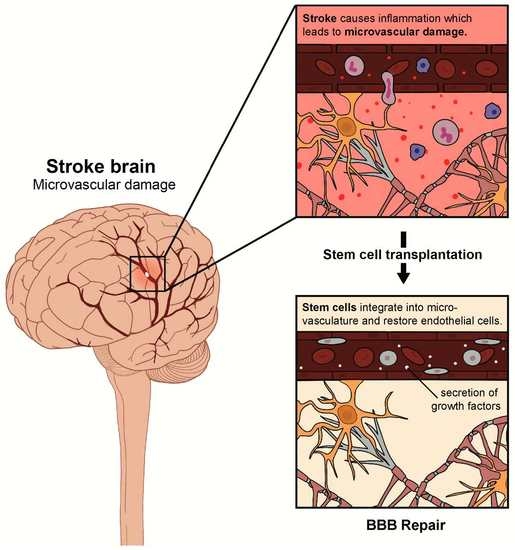 Cells Free FullText Stem Cell Repair of the Microvascular Damage