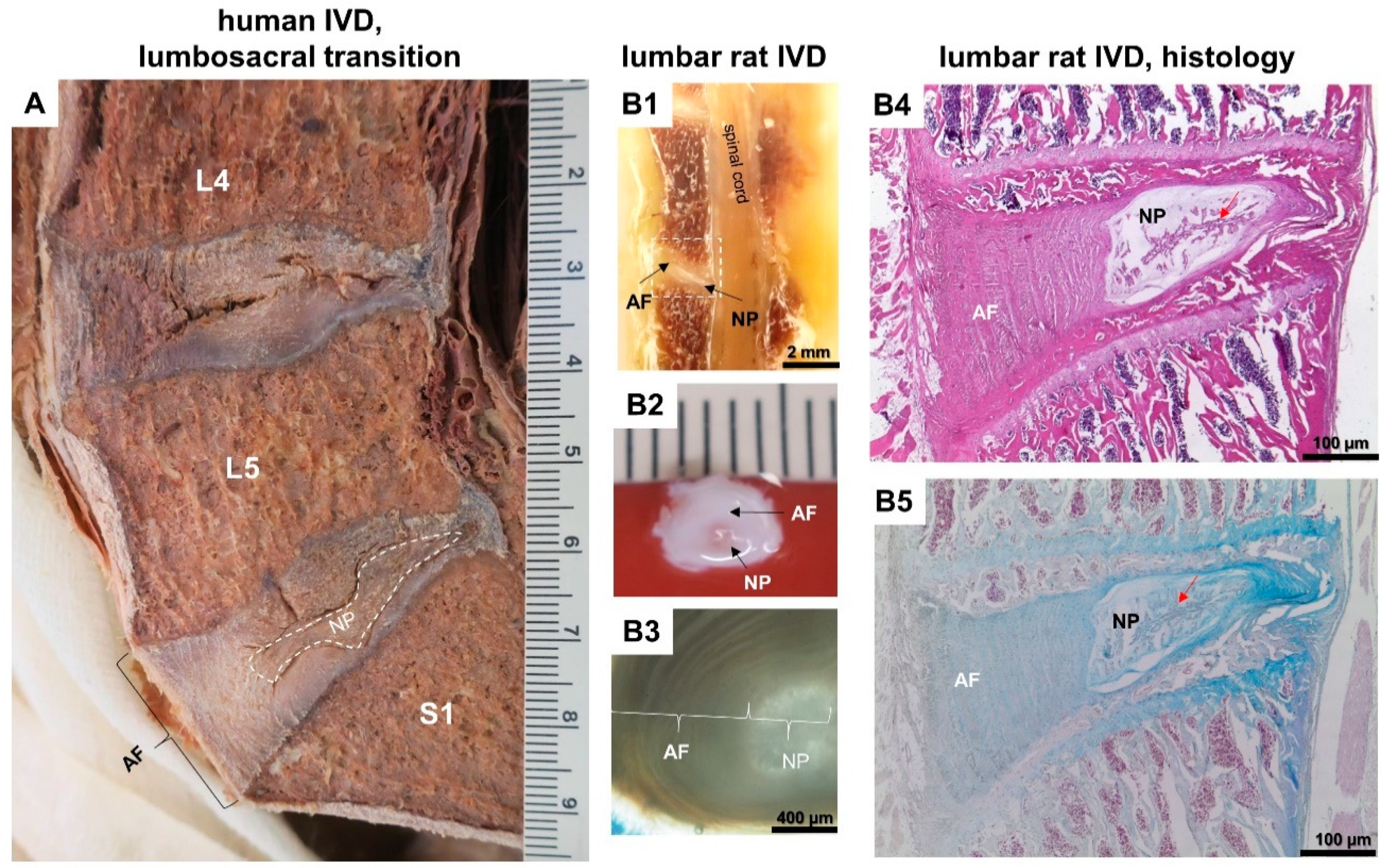 Cells Free Full Text The Relationship Between Diabetes Mellitus Type Ii And Intervertebral Disc Degeneration In Diabetic Rodent Models A Systematic And Comprehensive Review Html