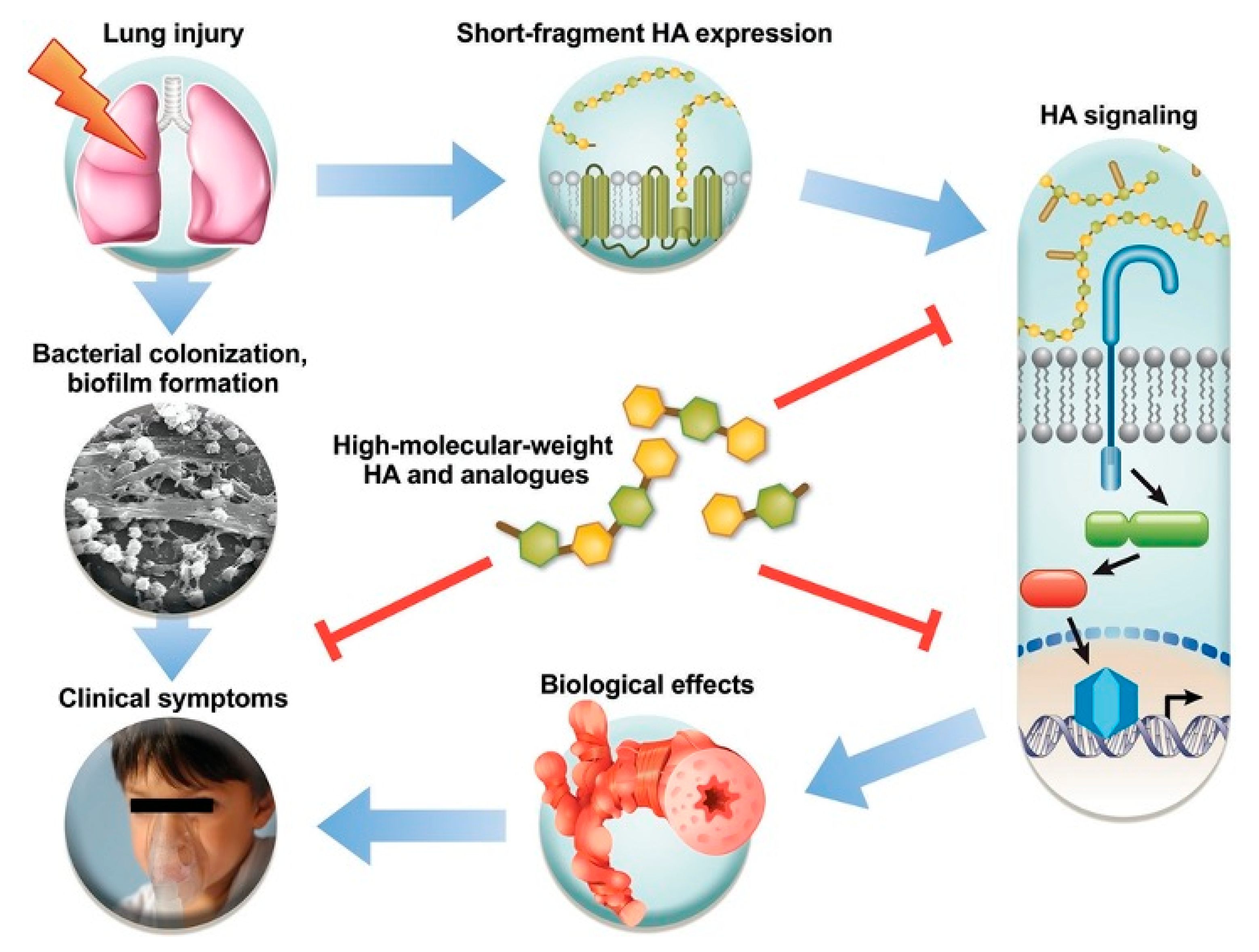 Cells Free FullText Use of Hyaluronic Acid (HA) in Chronic Airway