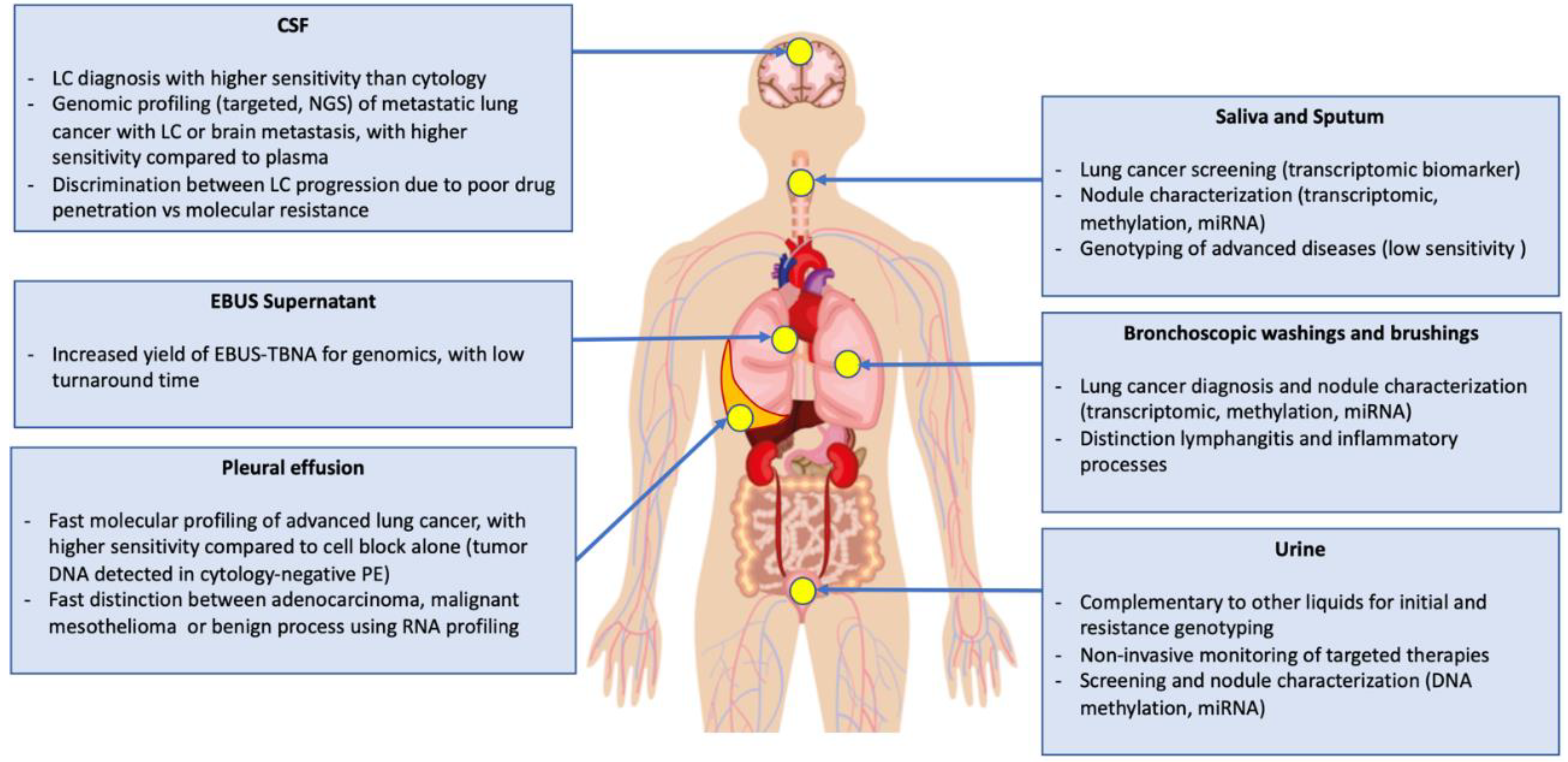 malignant mesothelioma multimodality therapy