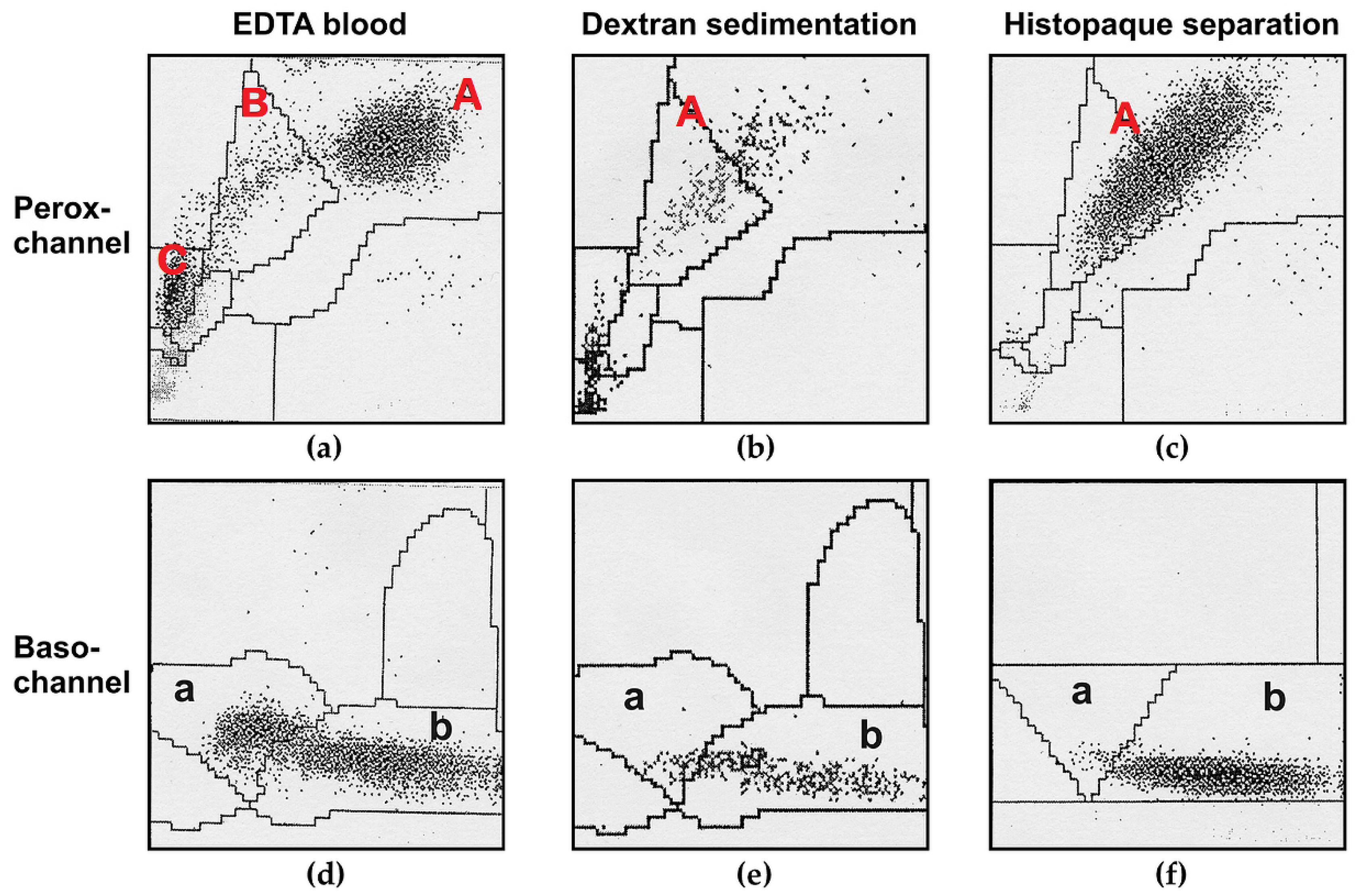 Cells Free Full Text Optimization Of Enzyme Essays To Enhance Reliability Of Activity Measurements In Leukocyte Lysates For The Diagnosis Of Metachromatic Leukodystrophy And Gangliosidoses Html