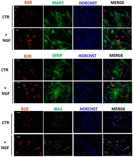 Involvement of Bradykinin Receptor 2 in Nerve Growth Factor ...