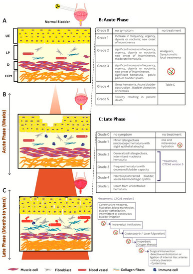 Cells Free Full Text Chronic Inflammation And Radiation Induced Cystitis Molecular Background And Therapeutic Perspectives Html Cells Free Full Text Chronic Inflammation And Radiation Induced Cystitis Molecular Background And Therapeutic Perspectives Html