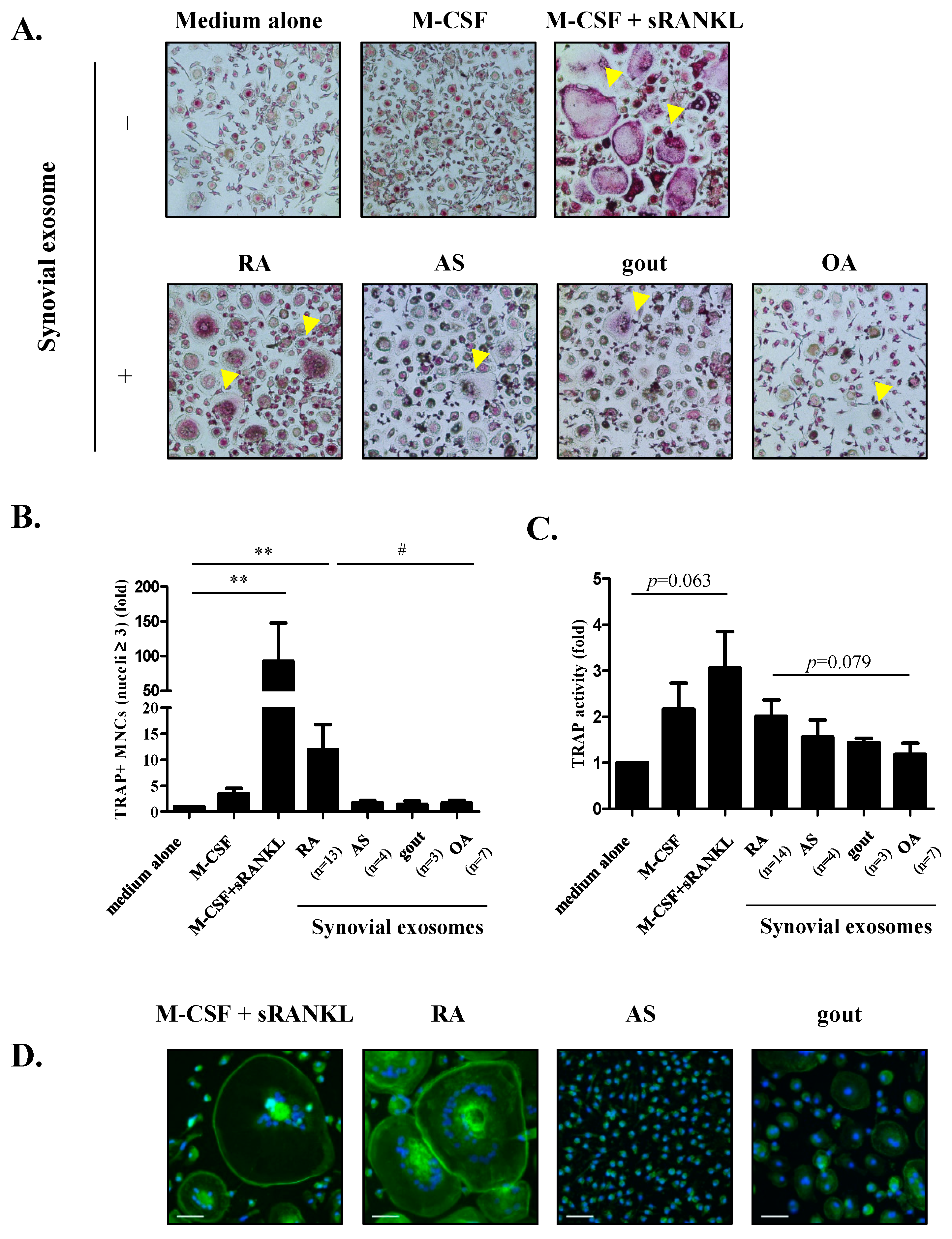 Cells Free Full Text Role Of Synovial Exosomes In Osteoclast Differentiation In Inflammatory Arthritis Html