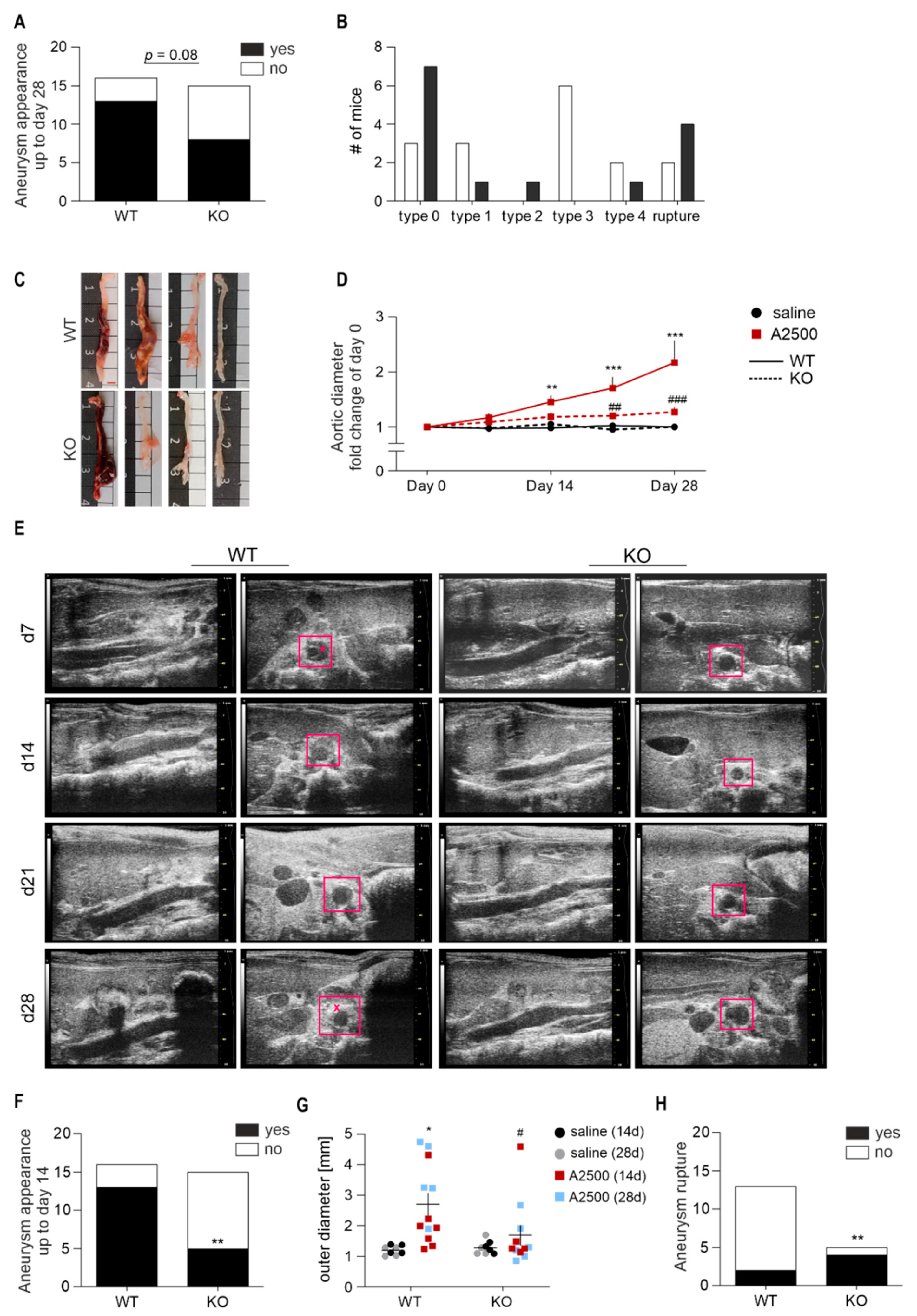 Cells Free Full Text A Dual Role Of Heme Oxygenase 1 In Angiotensin Ii Induced Abdominal Aortic Aneurysm In The Normolipidemic Mice Html Cells Free Full Text A Dual Role Of Heme Oxygenase 1 In Angiotensin Ii Induced Abdominal Aortic Aneurysm In The Normolipidemic Mice Html