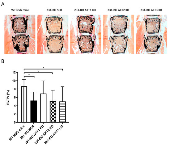 Knockdown of AKT3 Activates HER2 and DDR Kinases in Bone