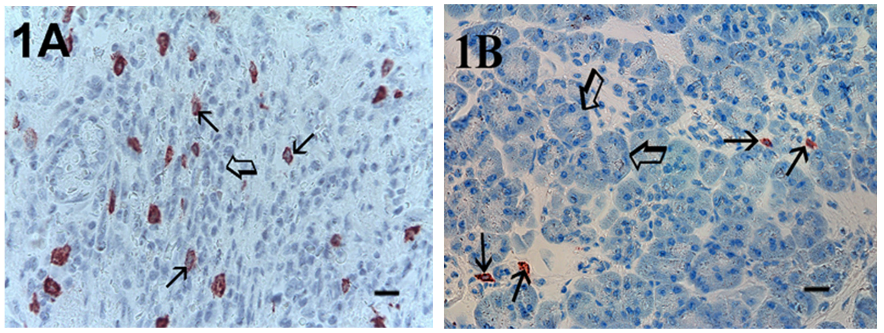Cells Free Full Text Mast Cells Positive For C Kit Receptor And Tryptase Correlate With Angiogenesis In Cancerous And Adjacent Normal Pancreatic Tissue Html Cells Free Full Text Mast Cells Positive For C Kit Receptor And Tryptase Correlate With Angiogenesis In Cancerous And Adjacent Normal Pancreatic Tissue Html
