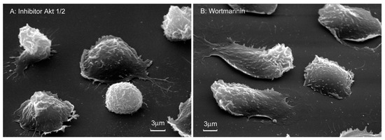 Neutrophil Adhesion and the Release of the Free Amino Acid Hydroxylysine