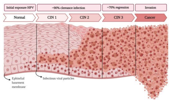 papilloma virus e cin 3