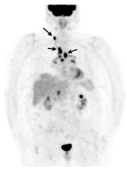 Cells 10 00766 g009 550