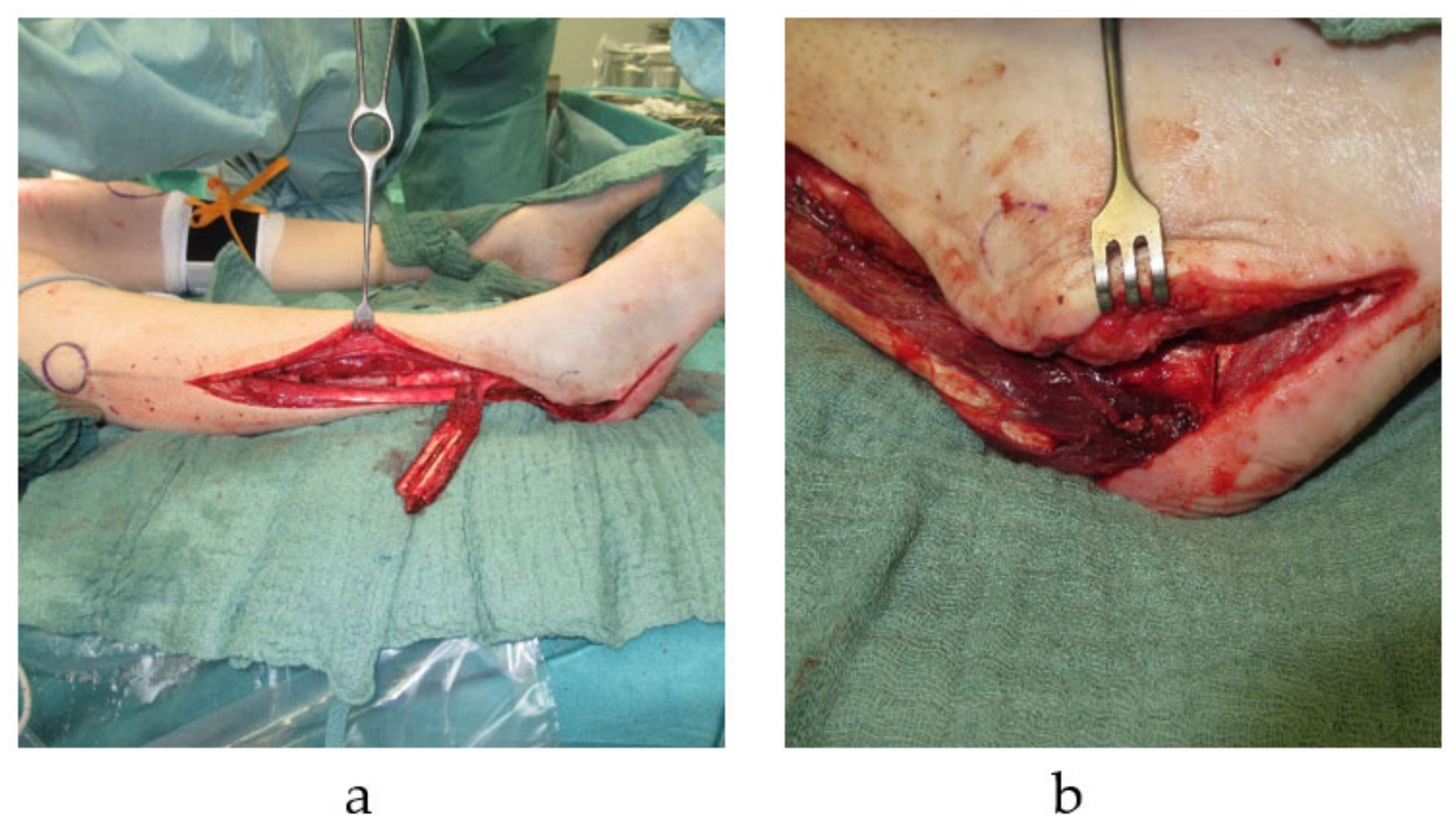 Cells 10 00975 g001 Cells 10 00975 g001