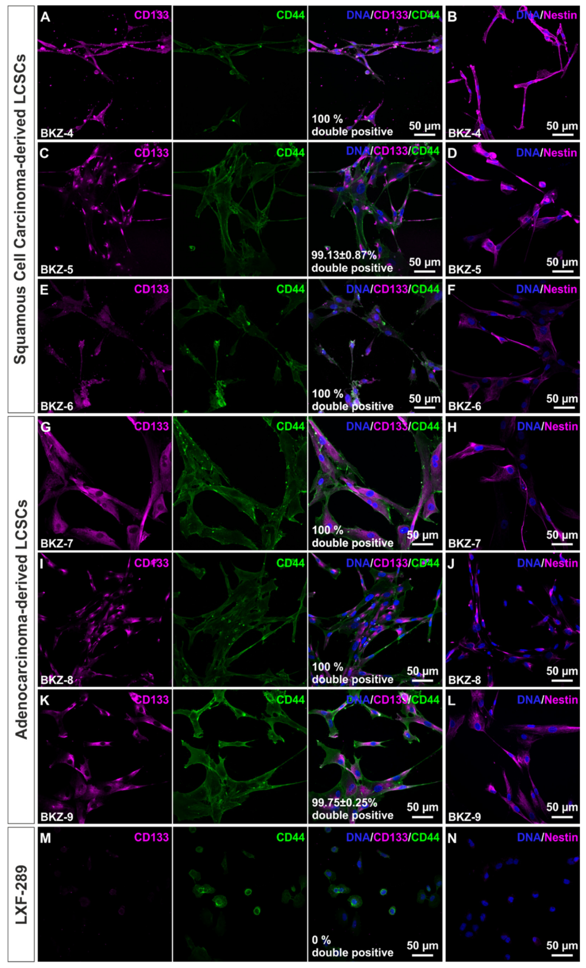 Cells Free Full Text Novel Primary Human Cancer Stem Like Cell Populations From Non Small Cell Lung Cancer Inhibition Of Cell Survival By Targeting Nf Kb And Myc Signaling Html