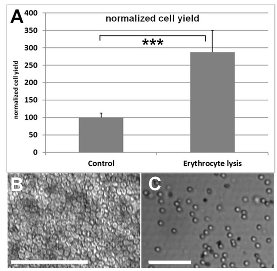 Cells Free FullText Adipose TissueDerived Stem Cell Yield Depends on Isolation Protocol