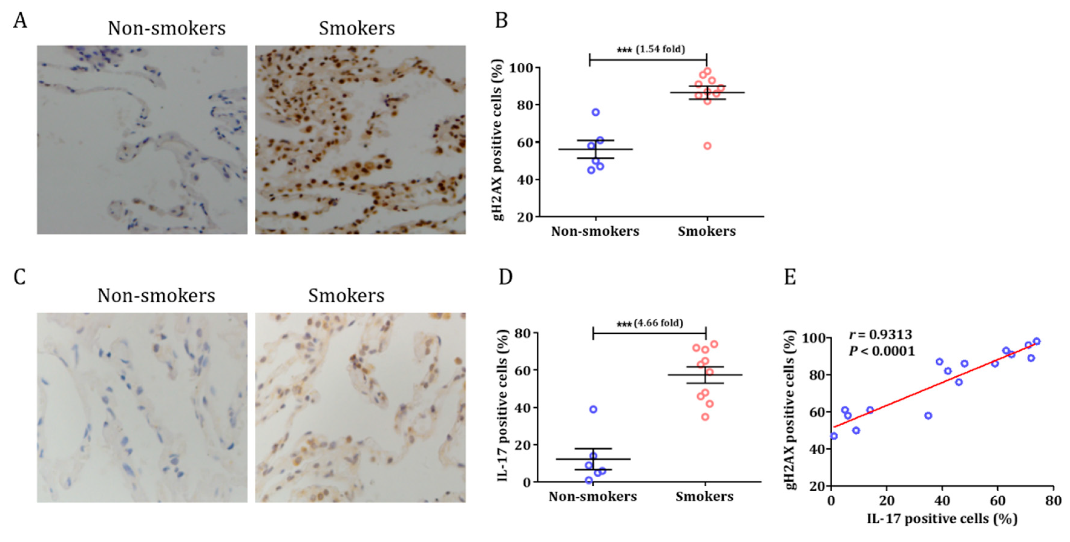 Cells | Free Full-Text | IL-17-Mediated Inflammation Promotes 