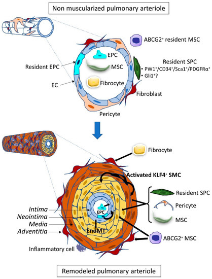 Braz J Cardiovasc Surg - The pulmonary vascular blood supply in