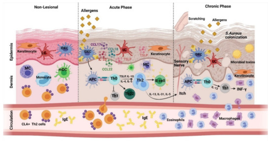 Current Insights into Immunology and Novel Therapeutics of Atopic