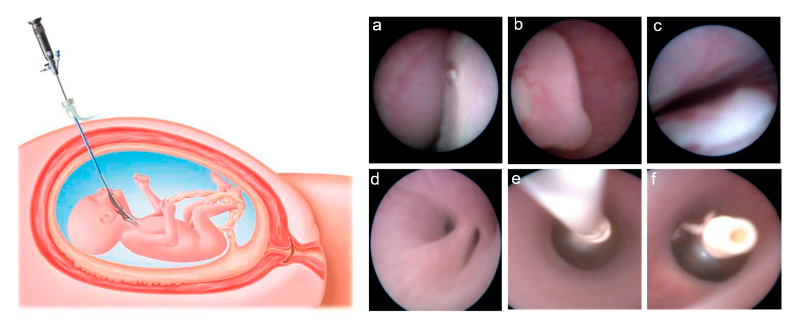 Cells 10 01493 g001 Cells 10 01493 g001