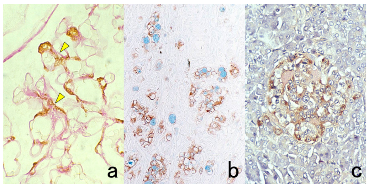 Cells Free Full Text Pitfalls And Caveats In Applying Chromogenic Immunostaining To Histopathological Diagnosis Html