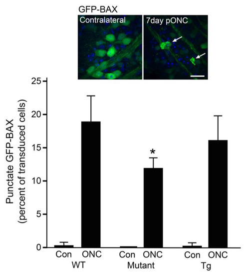 The Influence of Mitochondrial Dynamics and Function on