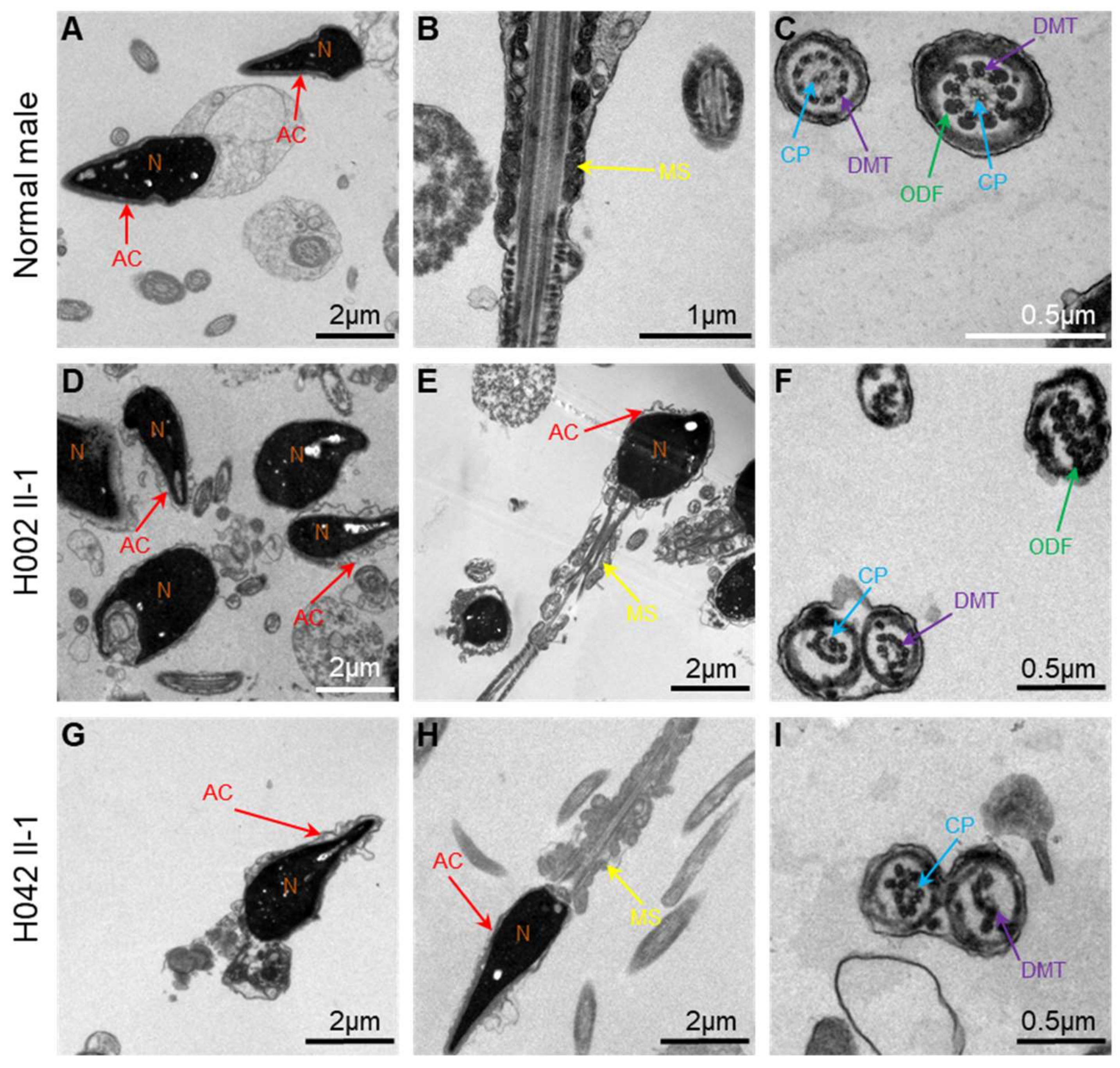 prejudice Challenge radar Cells | Free Full-Text | Novel Mutations in X-Linked, USP26-Induced Asthenoteratozoospermia and Male Infertility | HTML prejudice Challenge radar Cells | Free Full-Text | Novel Mutations in X-Linked, USP26-Induced Asthenoteratozoospermia and Male Infertility | HTML