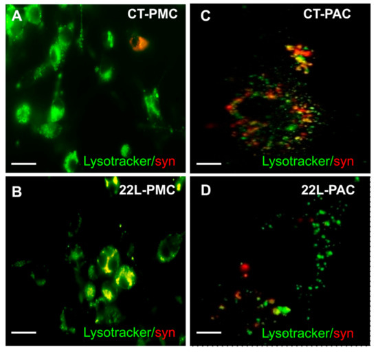 LIVE/DEAD Cell assay. a Control for live cells (normal astrocytes