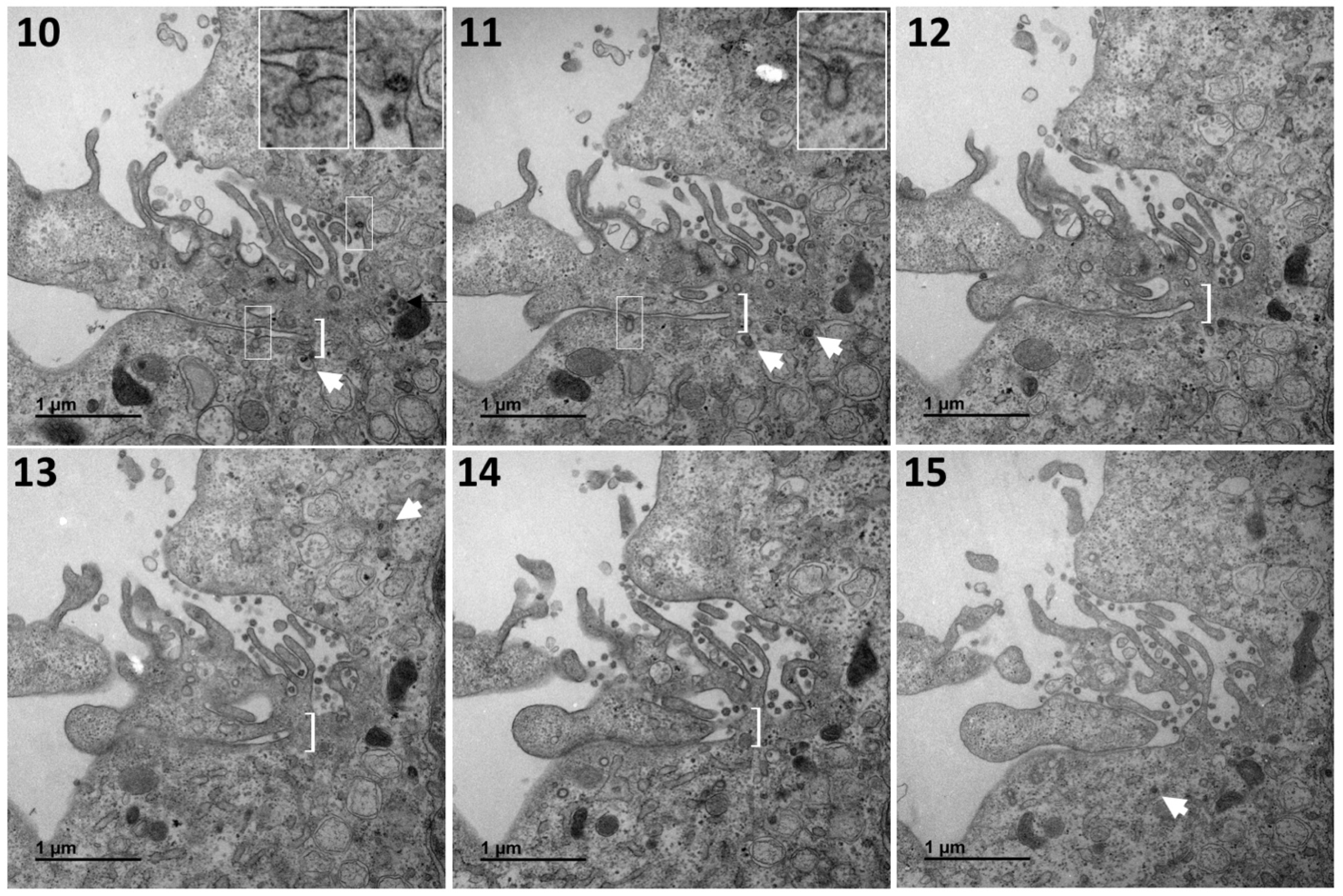 Cells 10 02047 g006b 550