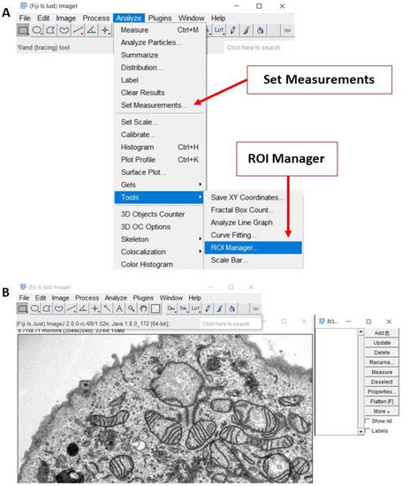 how to cite imagej software how to cite imagej software