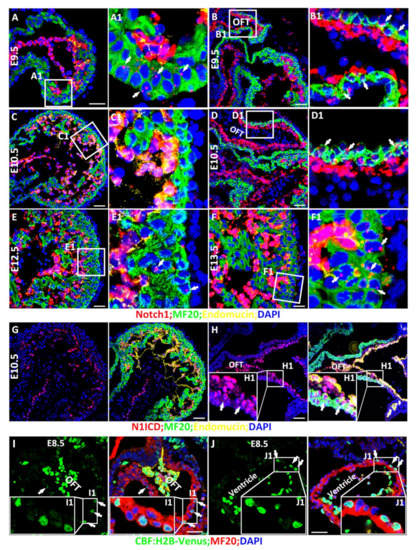 The Spatiotemporal Expression of Notch1 and Numb and Their