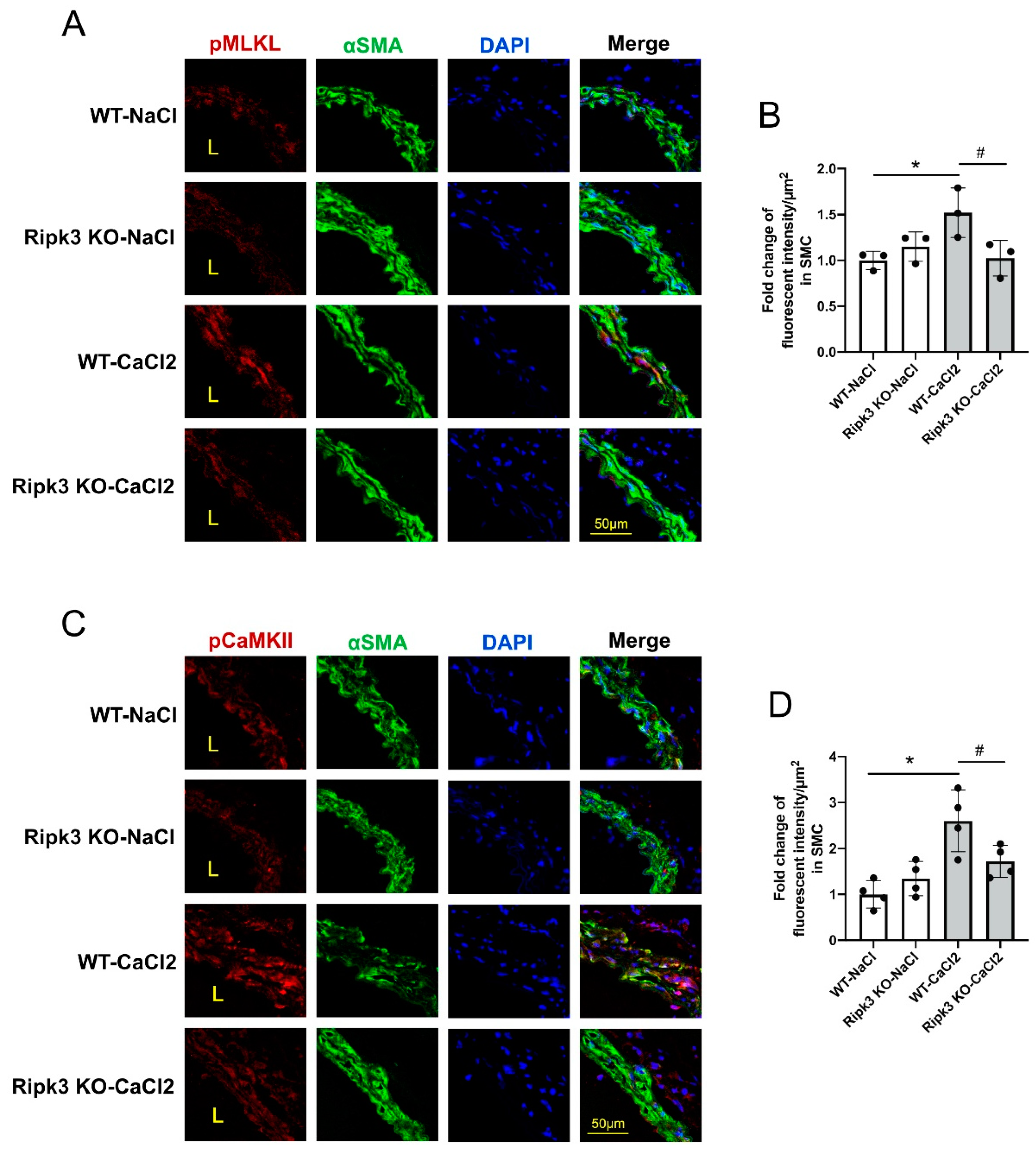 Cells Free Full Text Mlkl And Camkii Are Involved In Ripk3 Mediated Smooth Muscle Cell Necroptosis Html