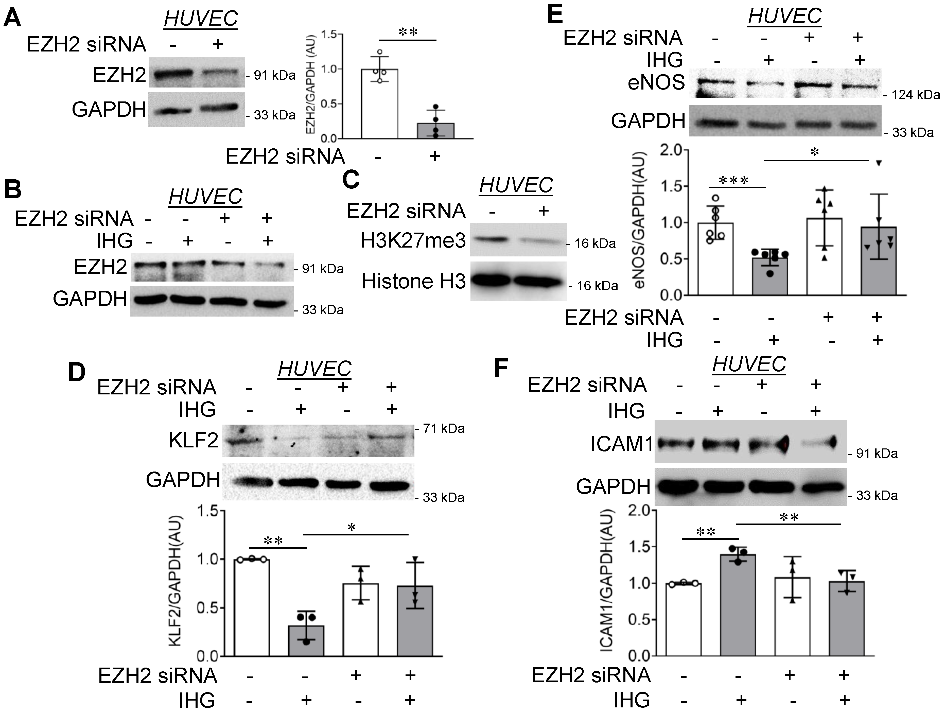Intermittent High Glucose Elevates Nuclear Localization of EZH2 to ...