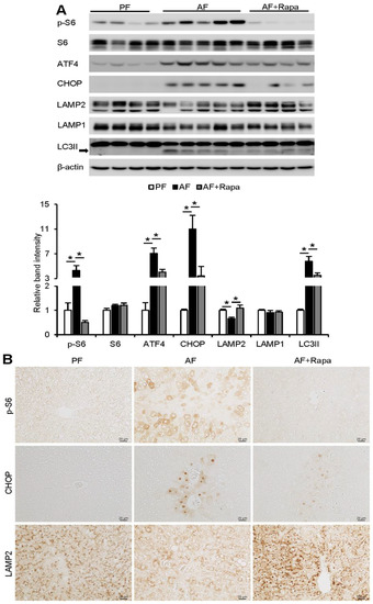 Activation of mTORC1 by Free Fatty Acids Suppresses LAMP2 and Autophagy ...