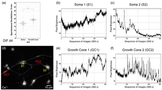 Grand average of event-related potentials recorded in the NMM, NM