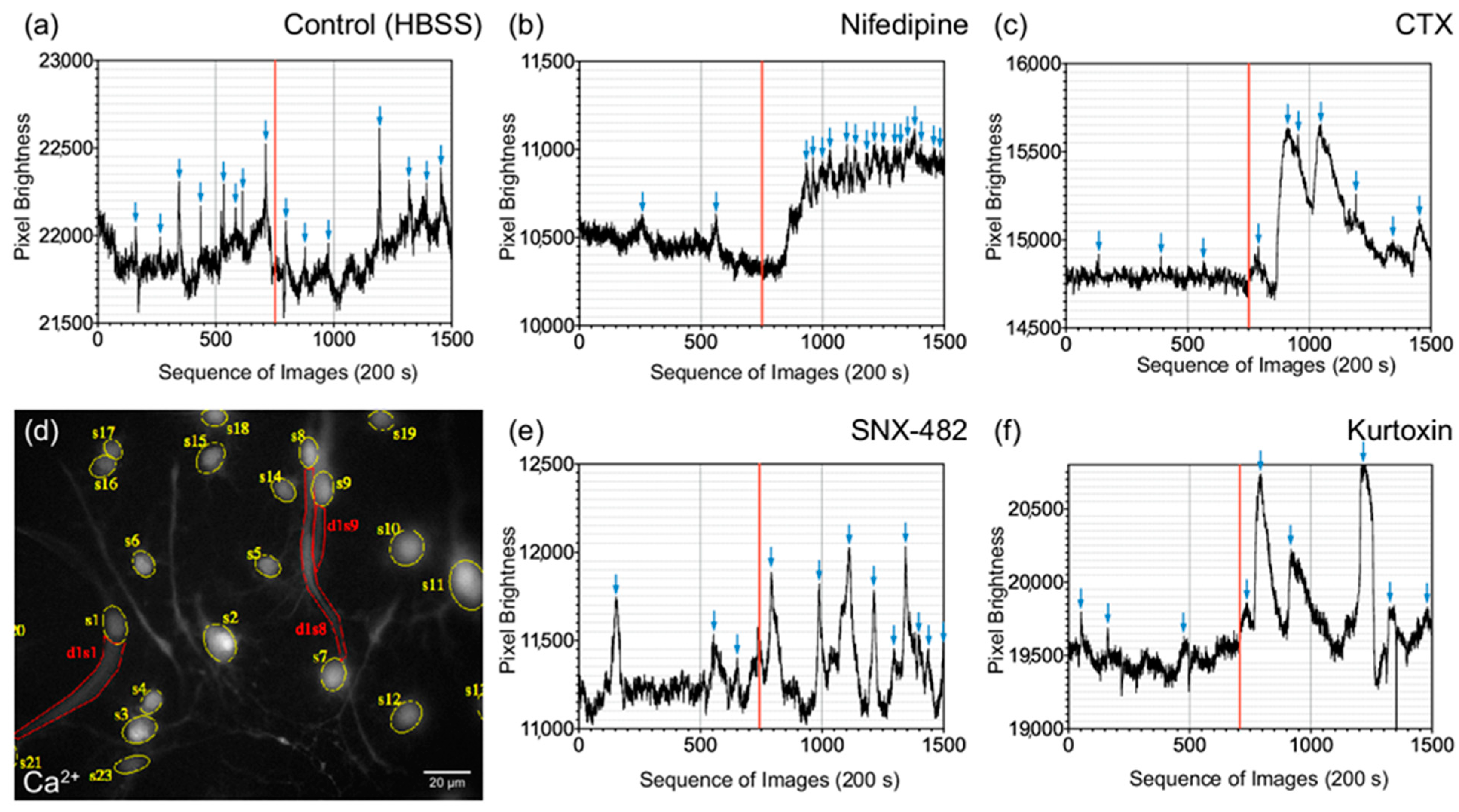 Grand average of event-related potentials recorded in the NMM and NM