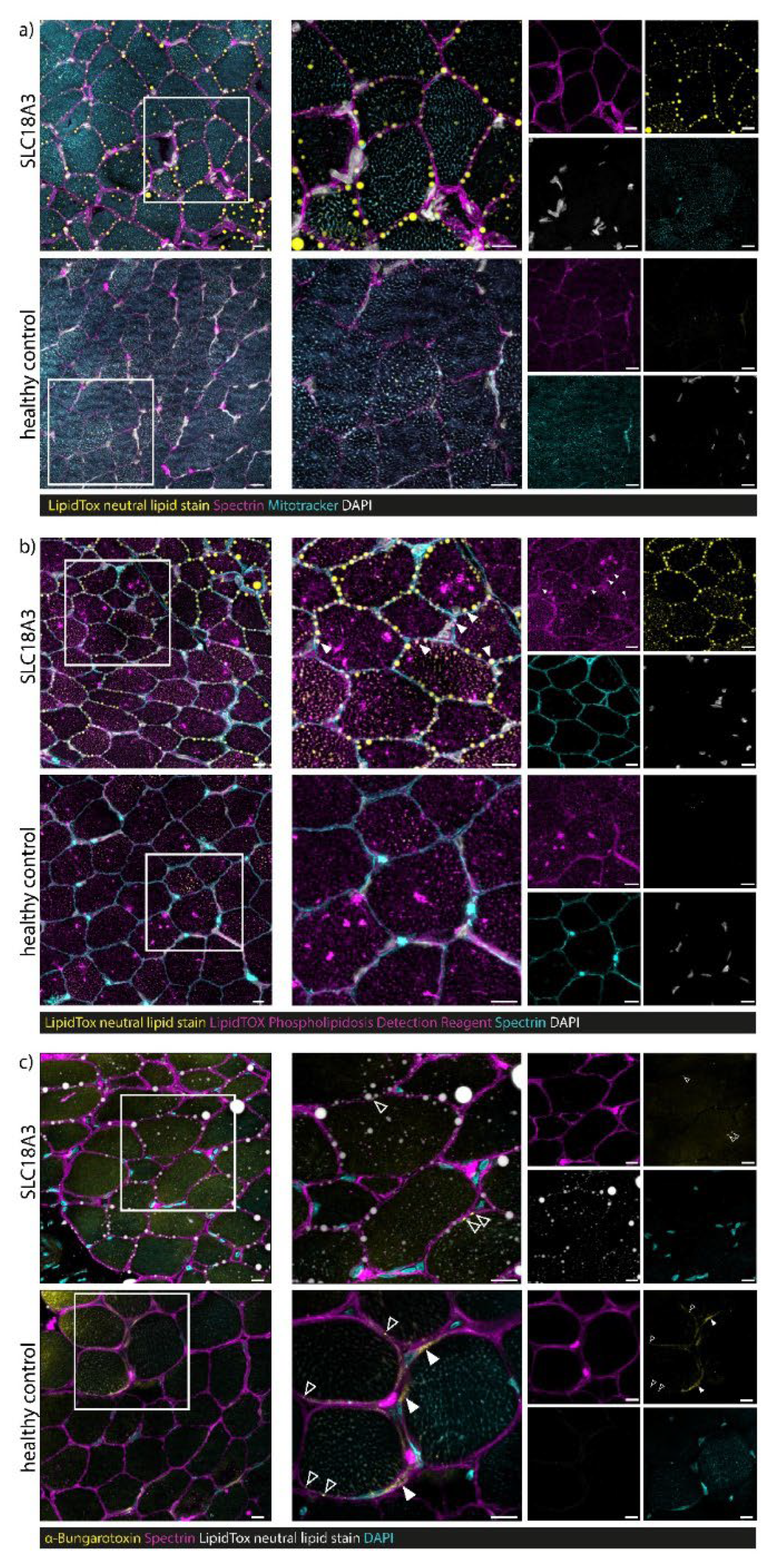 Cells 10 03481 g005 550
