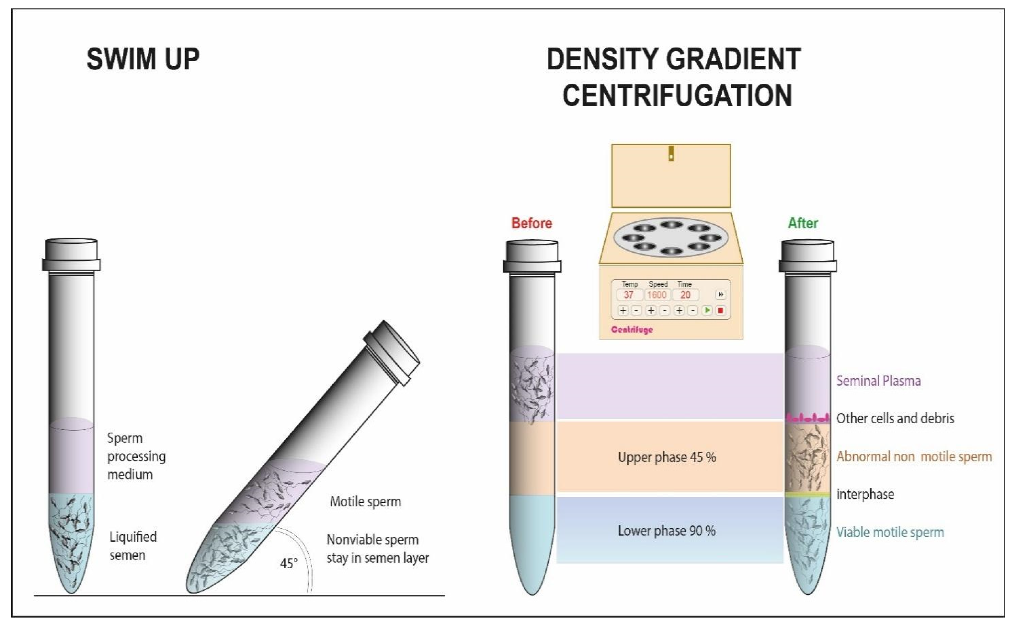 Cells Free Full-Text Sperm Selection for ICSI Do We Have a Winner?