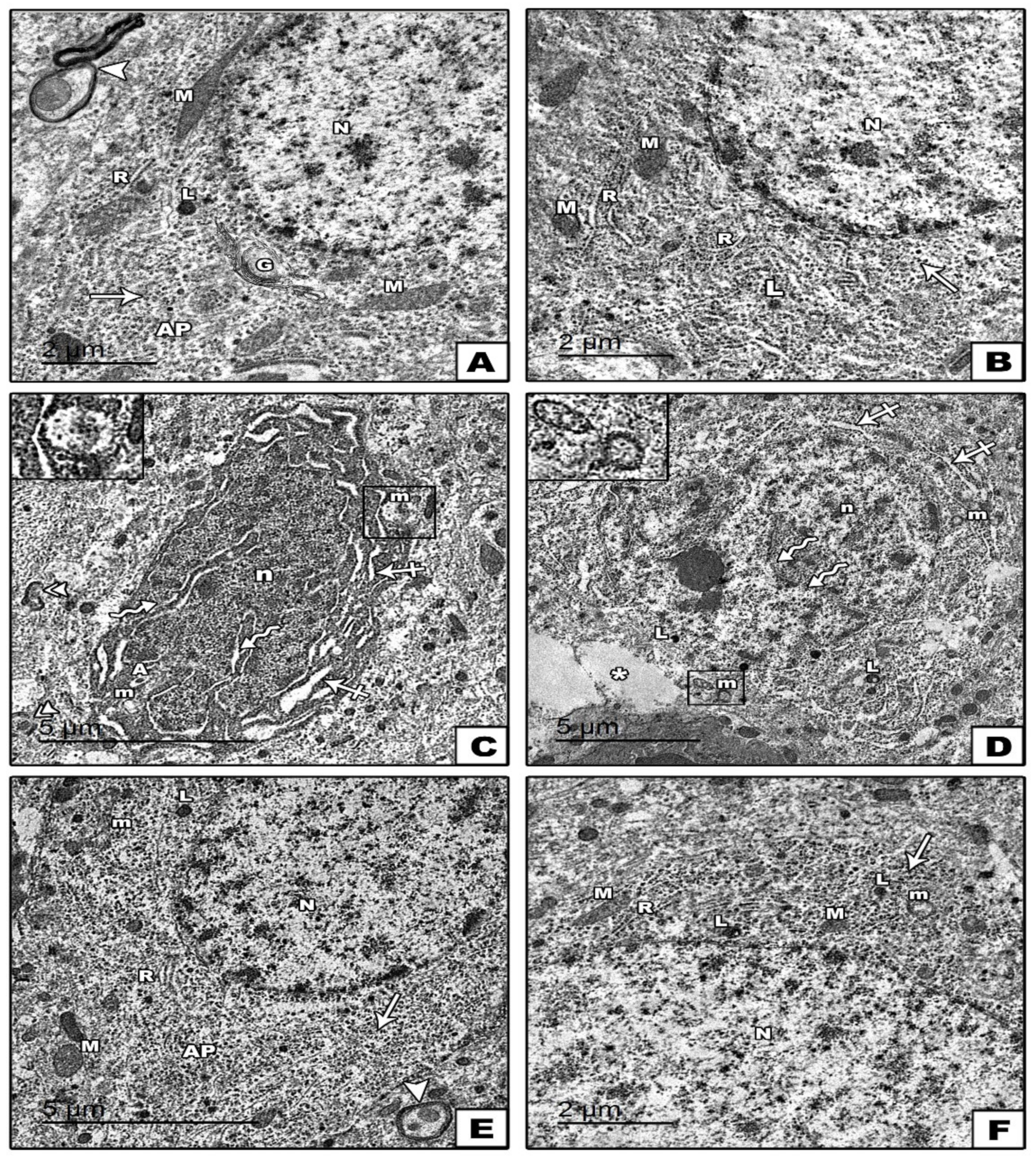 Cells 11 00048 g007 Cells 11 00048 g007