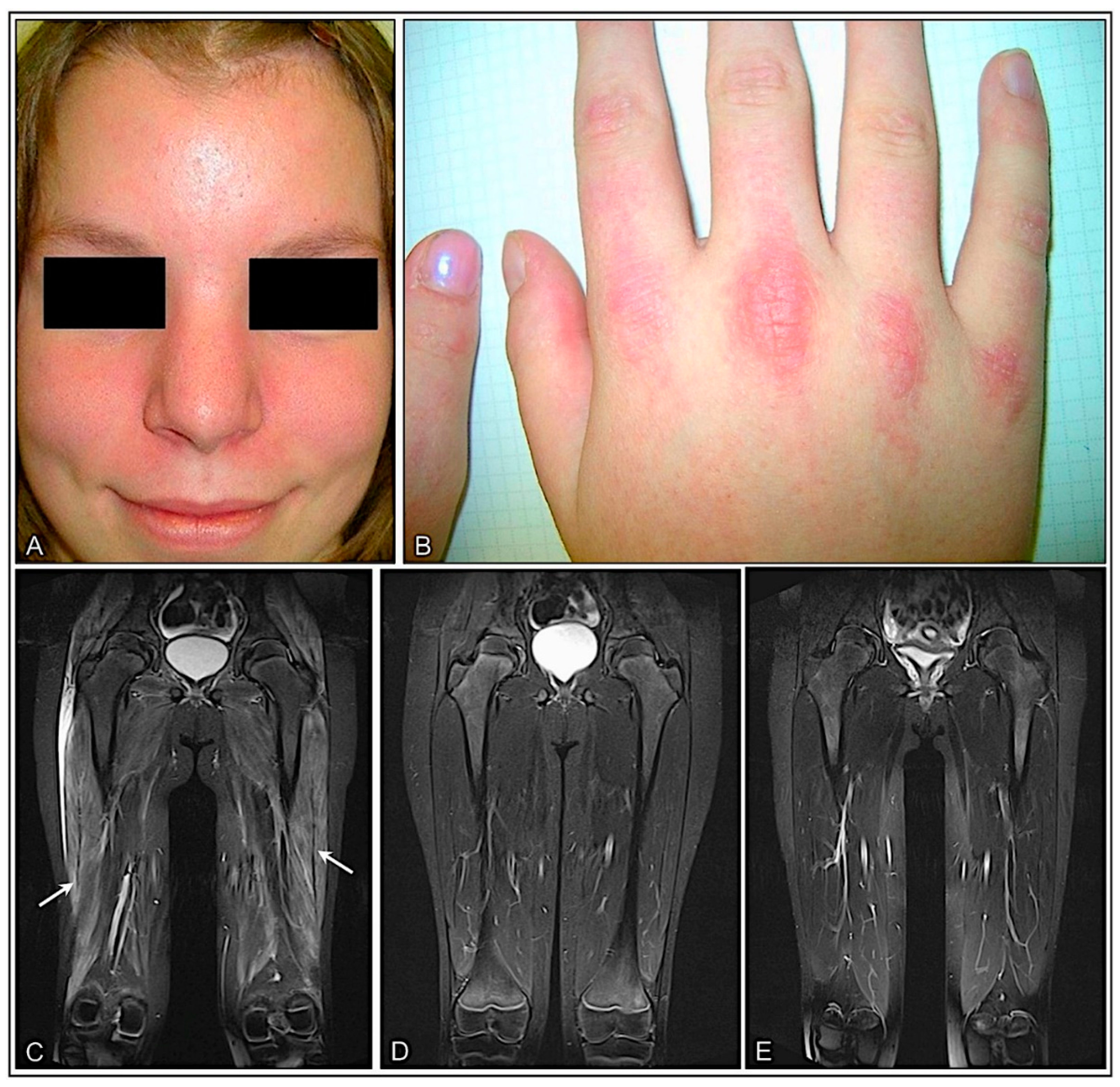 Cells 11 00109 g002 Cells 11 00109 g002