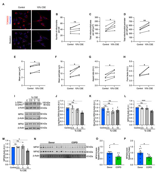 Extracellular Release of Mitochondrial DNA: Triggered by Cigarette Smoke  and Detected in COPD