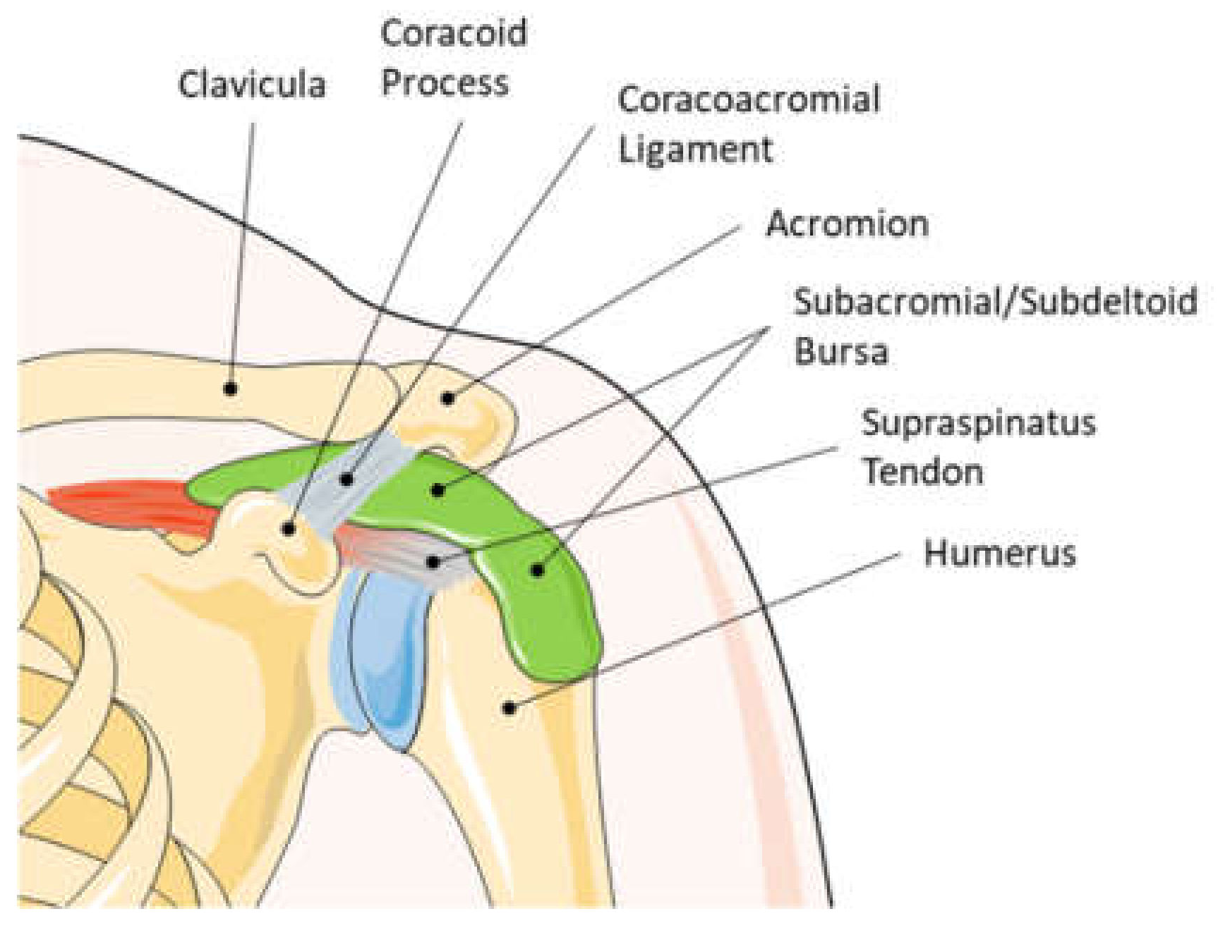 humeroscapularis arthrosis