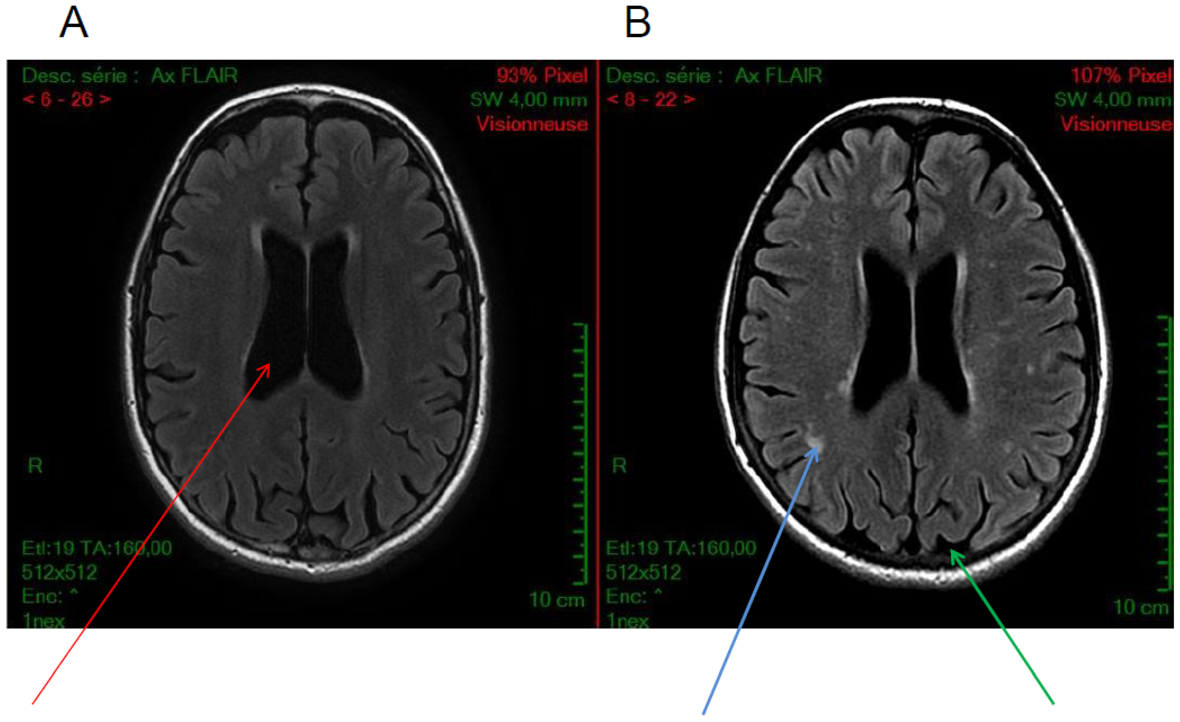 Cells 11 00682 g002a