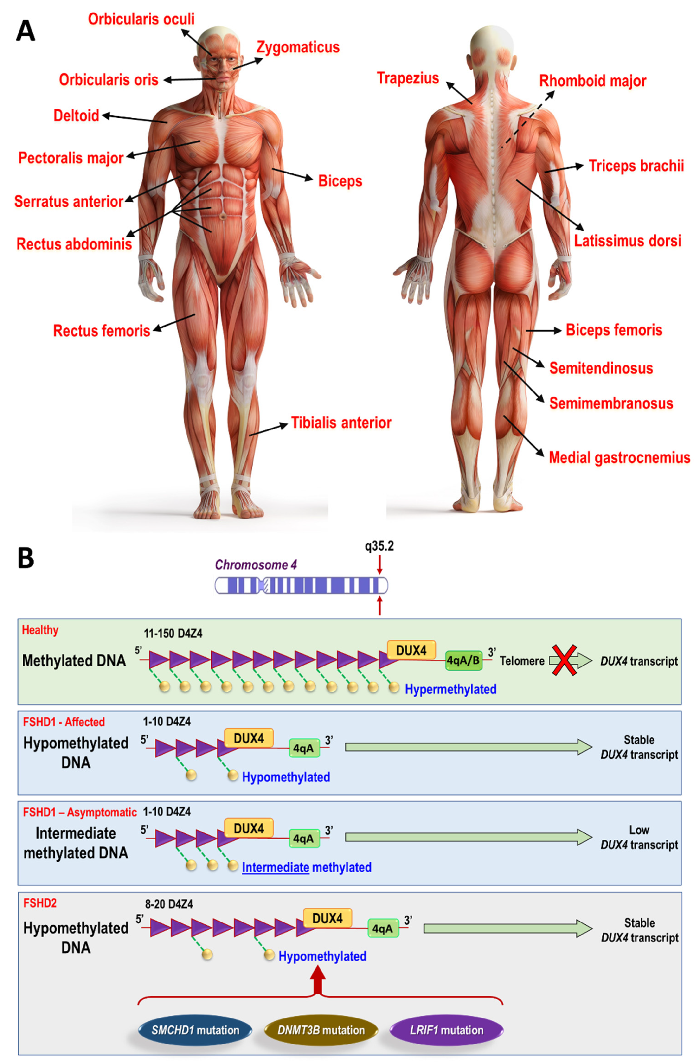 Description of muscle disease – specific diseases (Section 3B