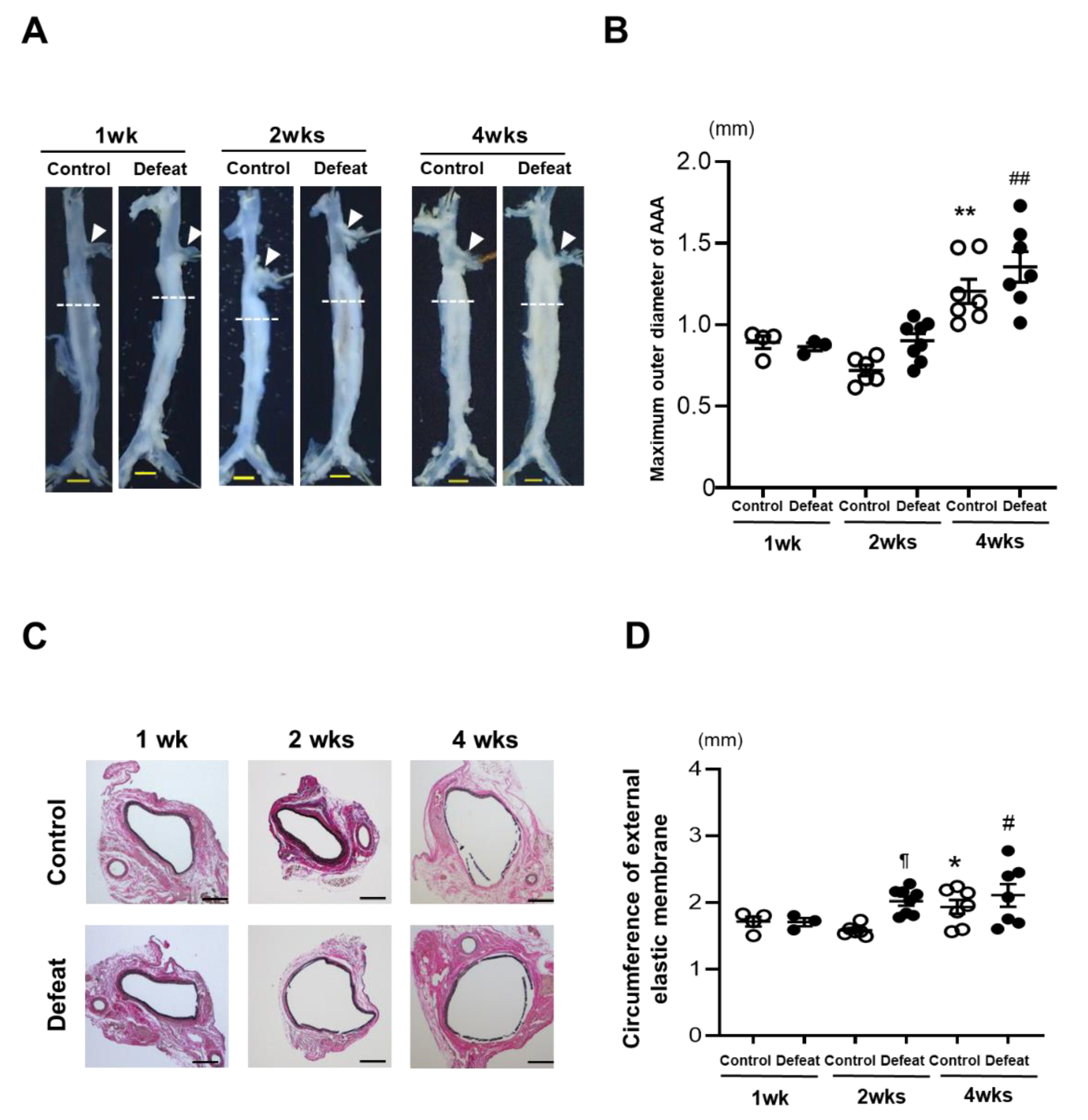 Cells Free Full Text Repeated Social Defeat Enhances Cacl2 Induced Abdominal Aortic Aneurysm Expansion By Inhibiting The Early Fibrotic Response Via The Mapk Mkp 1 Pathway Html