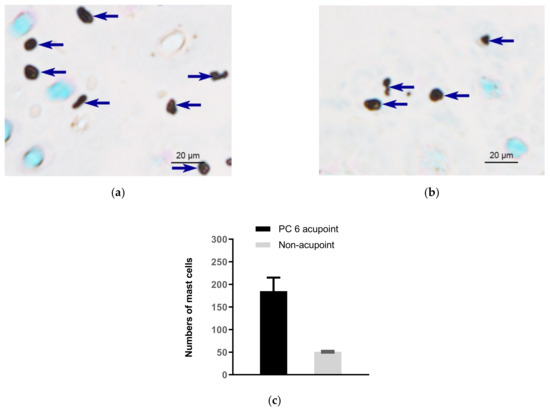 Activation of Subcutaneous Mast Cells in Acupuncture Points