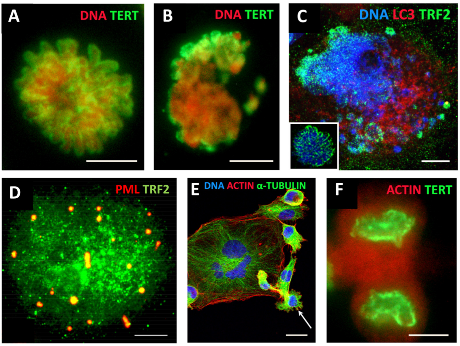 Cells 11 00880 g003 Cells 11 00880 g003