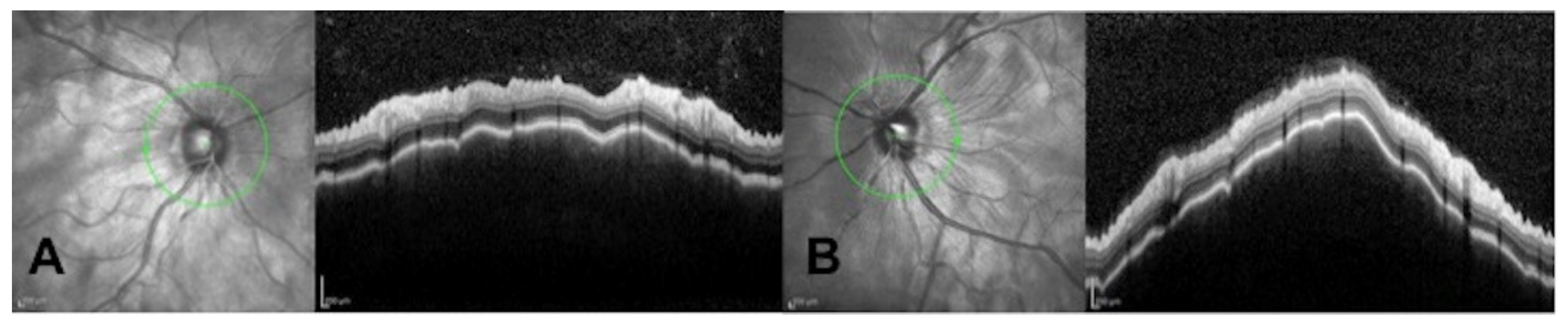 Cells 11 01012 g003 550