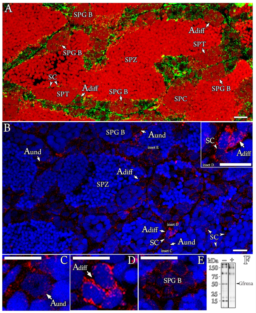 Cells 11 01295 g005 Cells 11 01295 g005