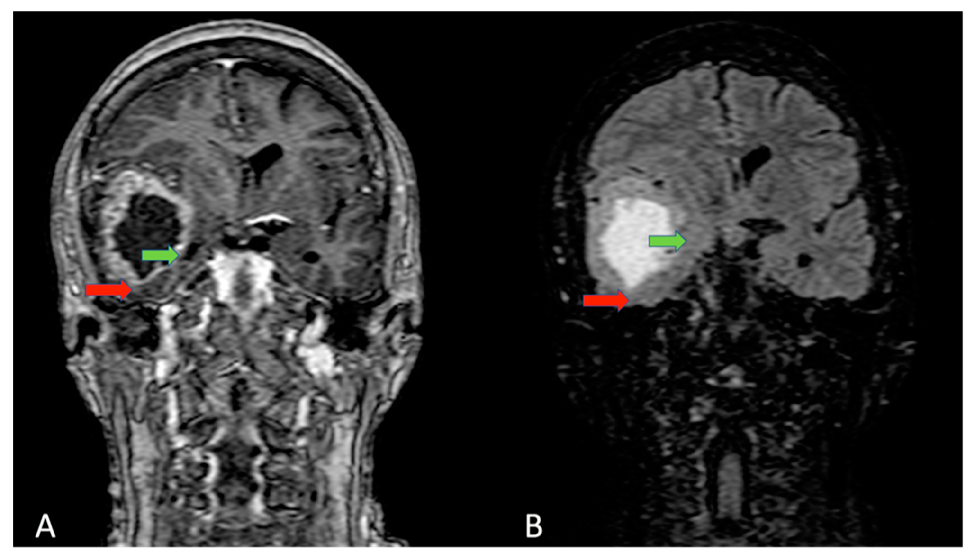 Cells 11 01349 g001 Cells 11 01349 g001