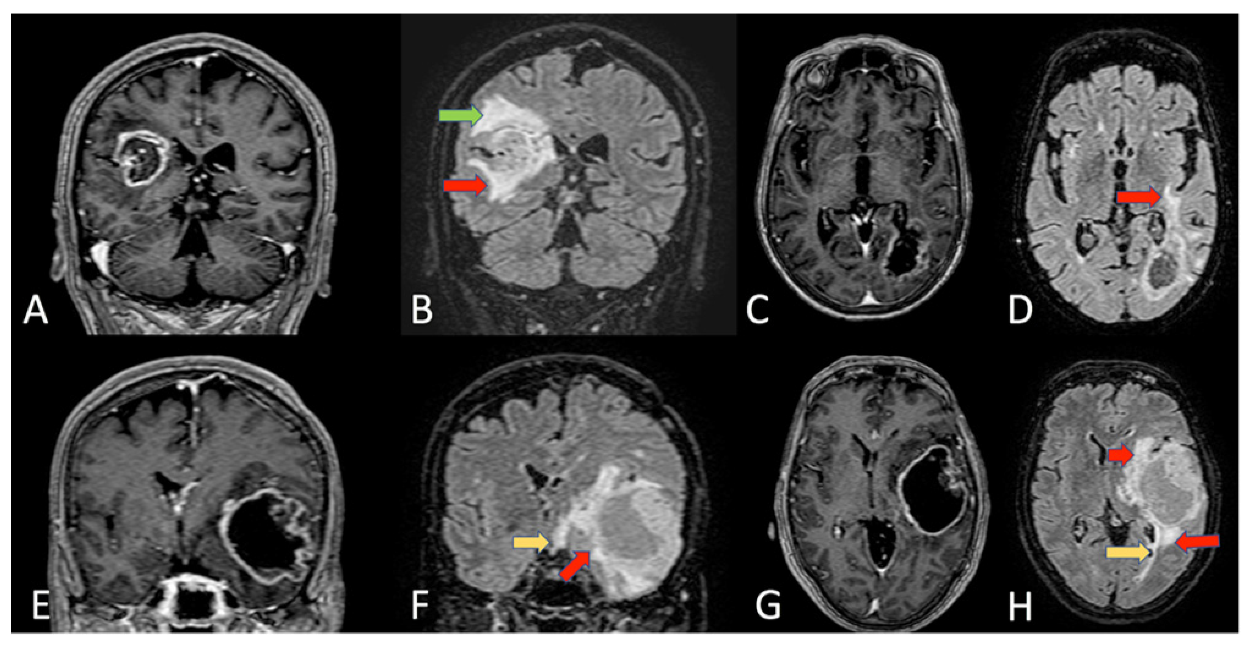 Cells 11 01349 g004 Cells 11 01349 g004